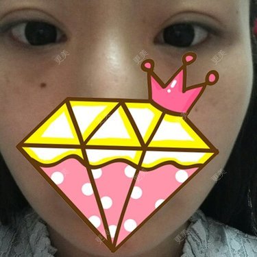 刘小肥