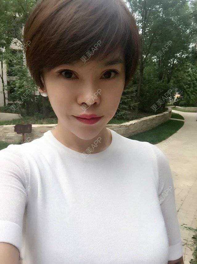 更美 - 苹果和小矮人的经验 | 黄金微针 | 北京