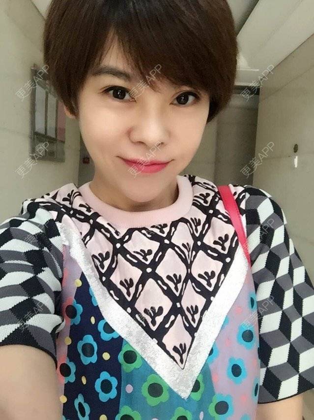 更美 - 苹果和小矮人的经验 | 射频提升 | 北京