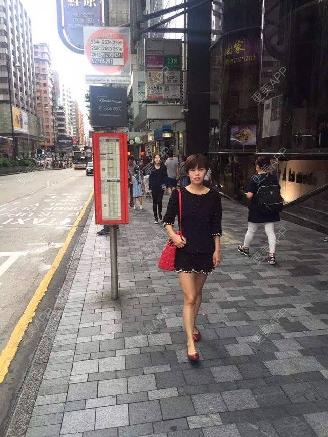 更美 - 苹果和小矮人的经验 | 射频提升 | 北京