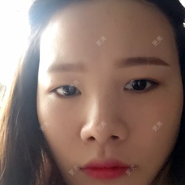 小笨丹