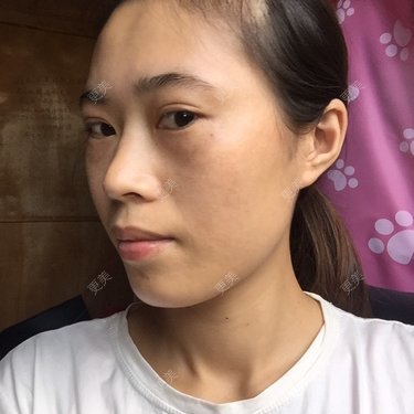 脸型不对称眼睛小太集中显得颧骨特别高脸尖而且长嘴唇嘴巴小不知道要