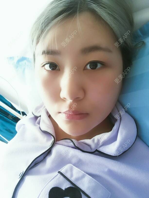 更美 - 不糖的经验 | 美购日记 | 双下巴 | 吸脂瘦脸 | 北京