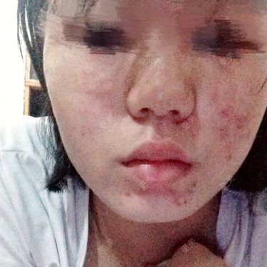 某某某迷