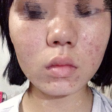 某某某迷