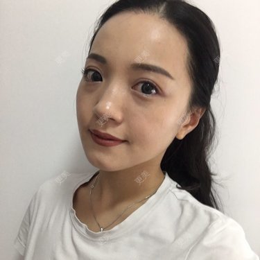 更美用户Etr80x5EJZ