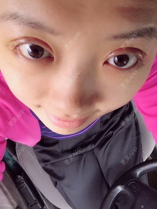 二子麻麻的双眼皮日记