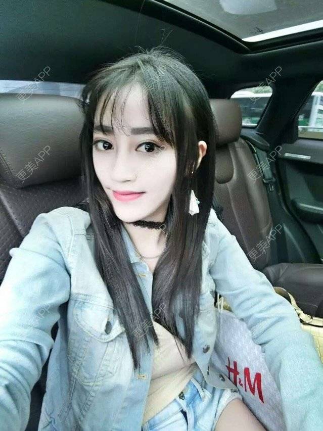 更美 - 兔宝宝的宝贝的自体脂肪全面部填充经验 | 自体脂肪全面部填充 | 面部轮廓 | 福州 | 热门讨论 | 面部吸脂填充 | 美购日记