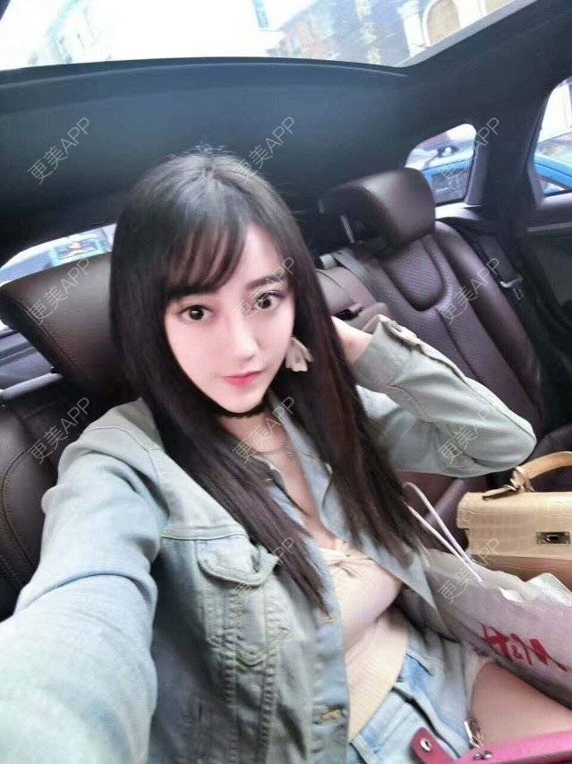 更美 - 兔宝宝的宝贝的自体脂肪全面部填充经验 | 自体脂肪全面部填充 | 面部轮廓 | 福州 | 热门讨论 | 面部吸脂填充 | 美购日记