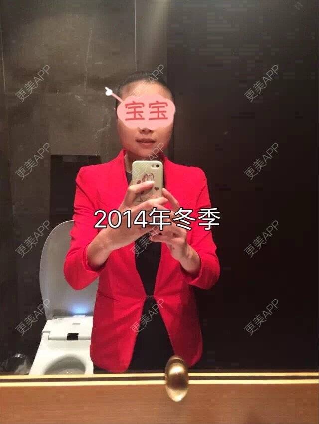 更美 - 家住山脚的姜小姐的除皱瘦脸经验 | 美购日记 | 除皱瘦脸 | 金华