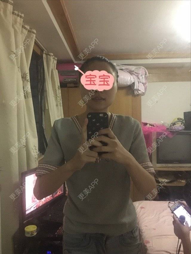 更美 - 家住山脚的姜小姐的除皱瘦脸经验 | 美购日记 | 除皱瘦脸 | 金华