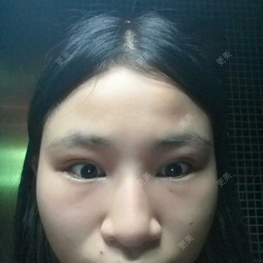 小白这个