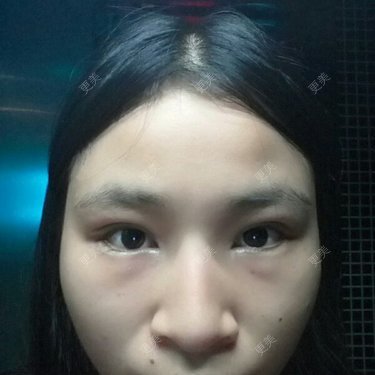 小白这个