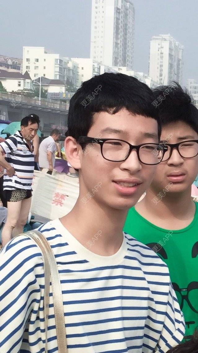 更美 - 李匿名的经验 | 修复双眼皮 | 大连
