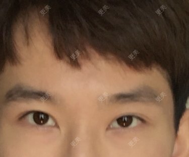 李匿名