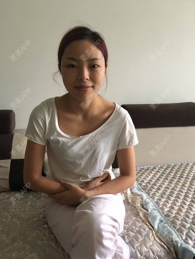 更美 - j s j s的经验 | 颧骨内推 | 在线面诊四 | 达州