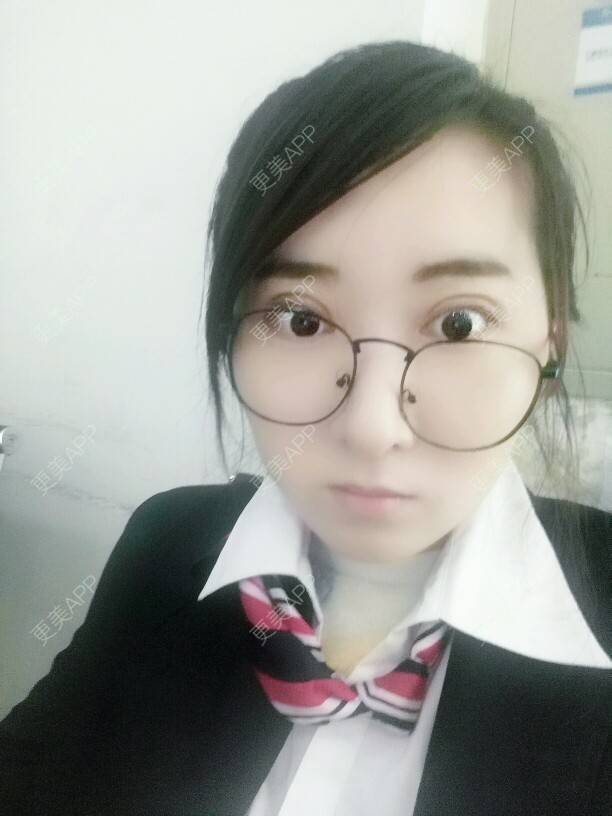 更美 - coral晨北北的经验 | 修复双眼皮 | 沈阳