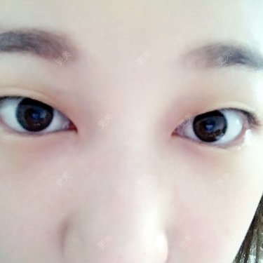 兔牙妹🤓