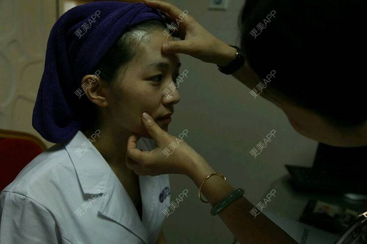 更美 - 更美用户hNPXHKzEsG的皮秒激光经验 | 皮秒激光 | 祛雀斑 | 东莞