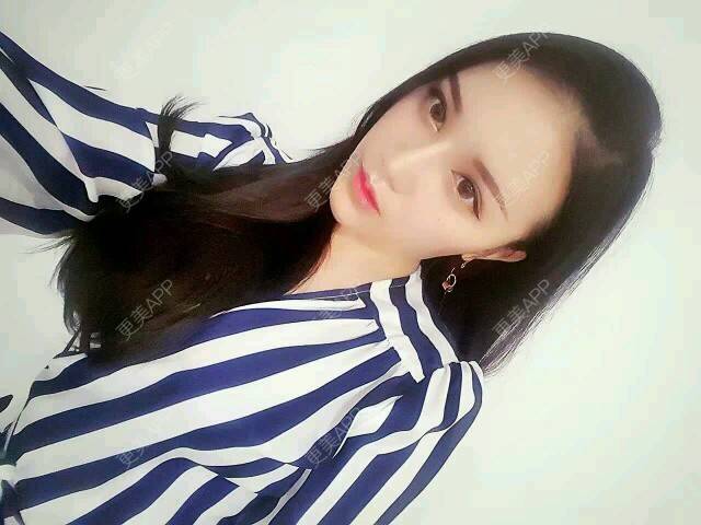 更美 - 杰西卡說她很忙的经验 | 激光溶脂瘦脸 | 南宁