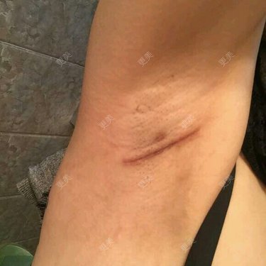 秋枫下的秋天