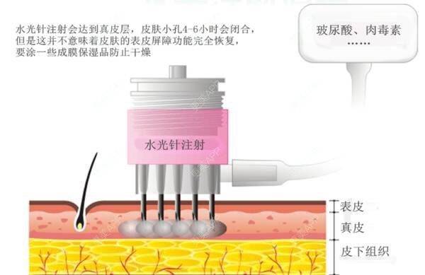 更美 - Rubybaby的经验 | 水光项目 | 皮肤管理 | 就要好皮肤 | 涩谷