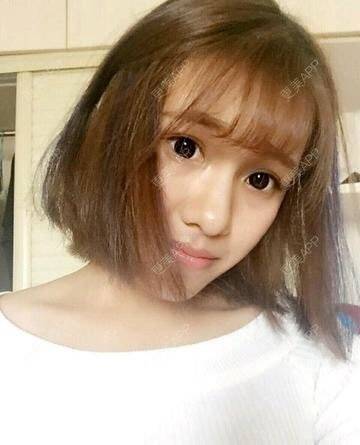 更美 - 土肥圆逆袭小仙女的玻尿酸经验 | 注射美容 | 瘦脸针美白针 | 温州 | 玻尿酸