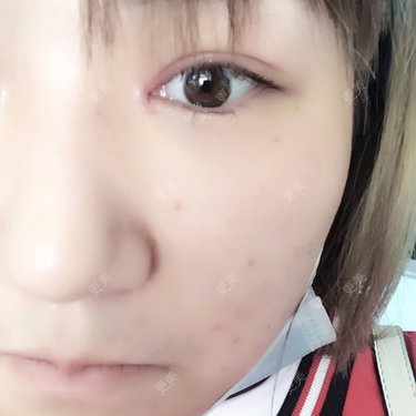 最初的小雅
