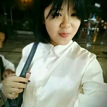 眼部整形