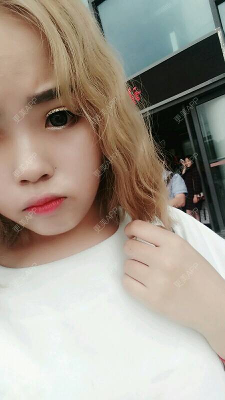 更美 - 小操 .的经验 | 凸嘴矫正 | 安阳