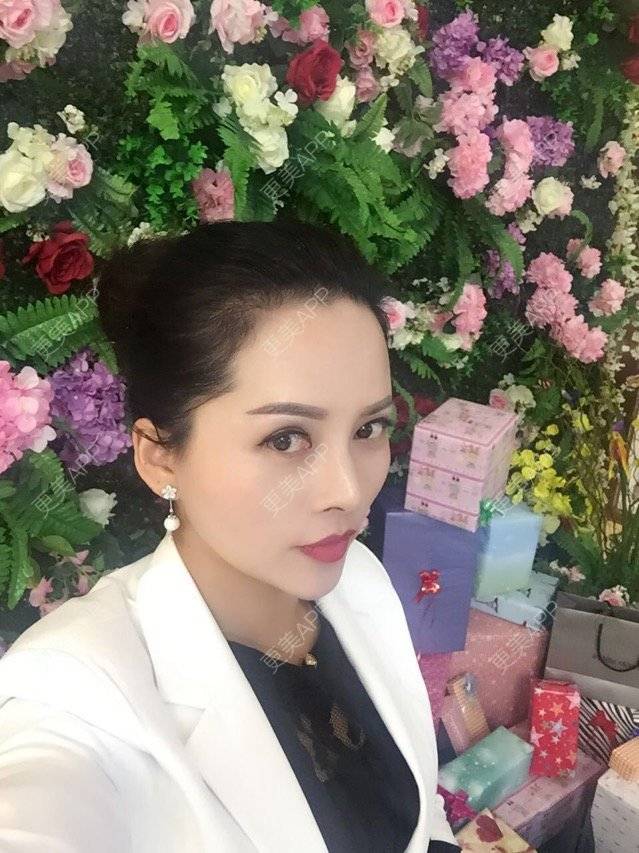 更美 - 武汉艺龄医疗美容医院的埋线提升经验 | 埋线提升