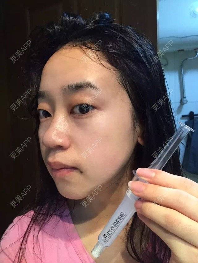 更美 - 小青青老师的经验 | 双眼皮 | 激光点痣 | 杭州
