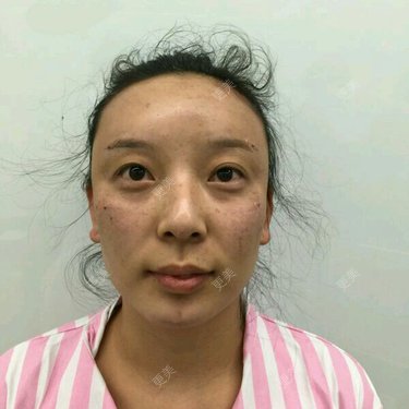 阿音是个美人