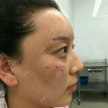 阿音是个美人