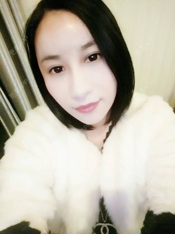 更美 - 更美用户Rgf5OmHSOo的自体脂肪全面部填充经验 | 美购日记 | 自体脂肪全面部填充 | 武汉