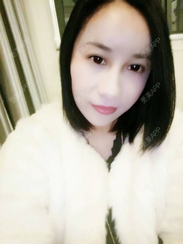 更美 - 更美用户Rgf5OmHSOo的自体脂肪全面部填充经验 | 美购日记 | 自体脂肪全面部填充 | 武汉