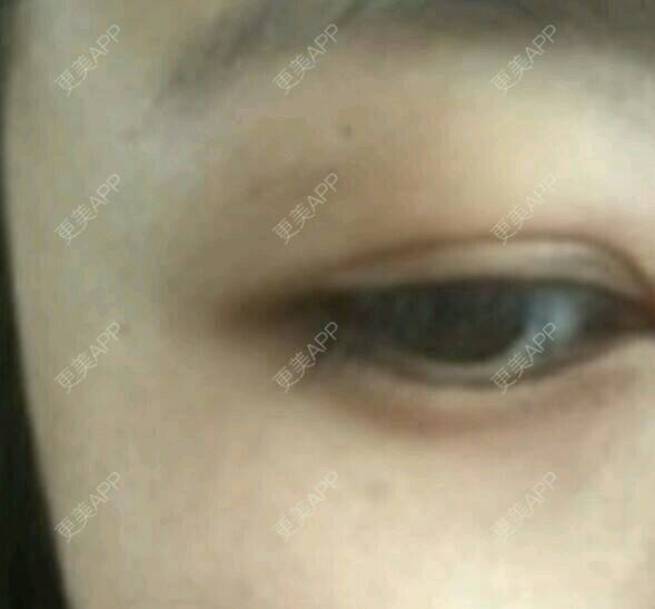 更美 - 更美用户6idwu60ovE的眼部护理经验 | 眼部护理 | 武汉