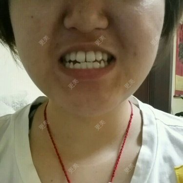 牙齿口腔