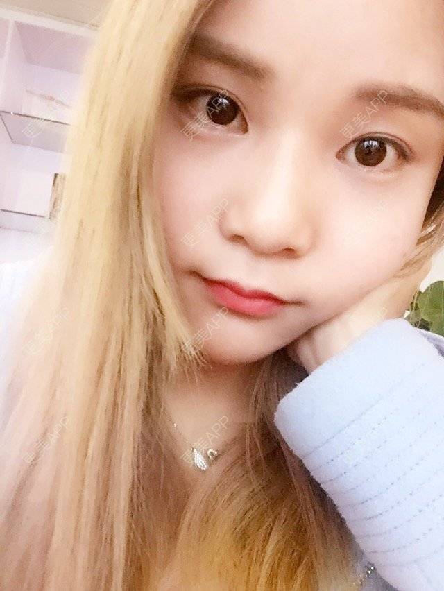 更美 - 喜宝i的冷光美白经验 | 口腔齿科 | 美购日记 | 洁牙 | 冷光美白 | 广州