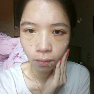 心疼妳的心疼。