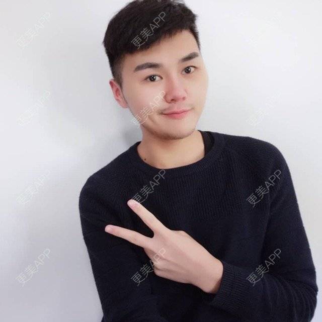 更美 - 彭彭Jerry的经验 | 面部轮廓 | 颧骨缩小术 | 颧骨颧弓内推 | 重庆