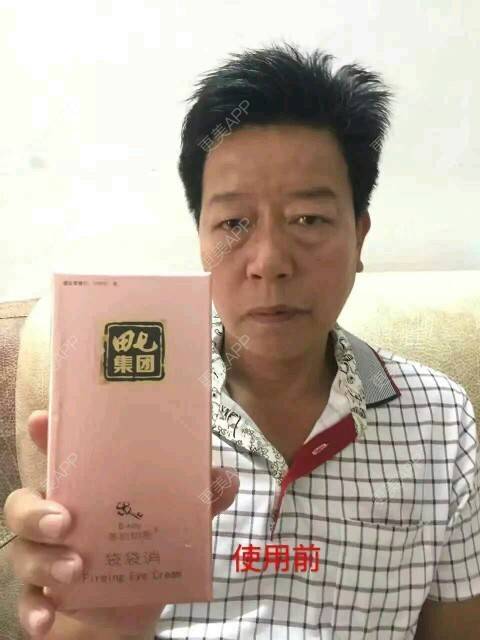 更美 - 塑造更美的你的经验 | 眼部整形 | 三分钟去眼袋 | 注射美容 | 郑州