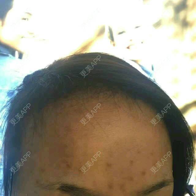 更美 - 塑造更美的你的经验 | 提亮肤色 | 郑州