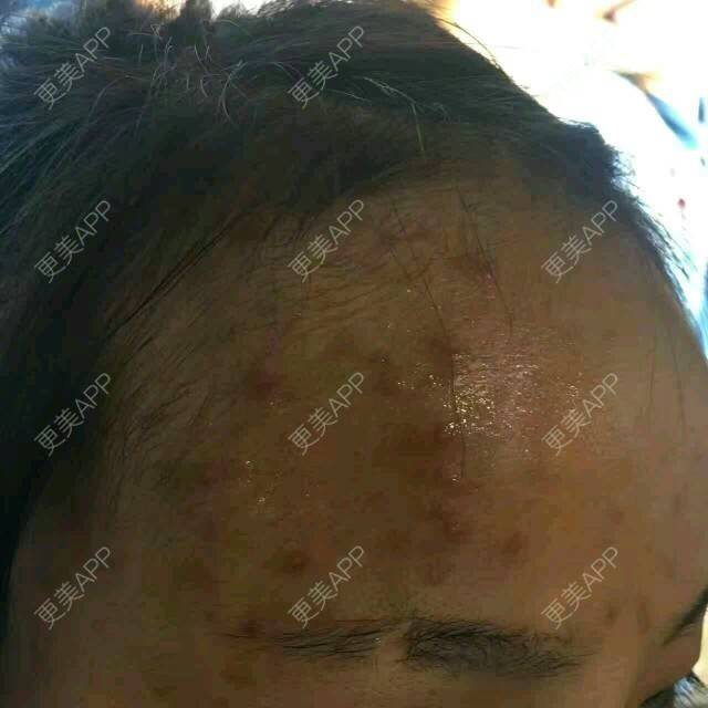 更美 - 塑造更美的你的经验 | 提亮肤色 | 郑州