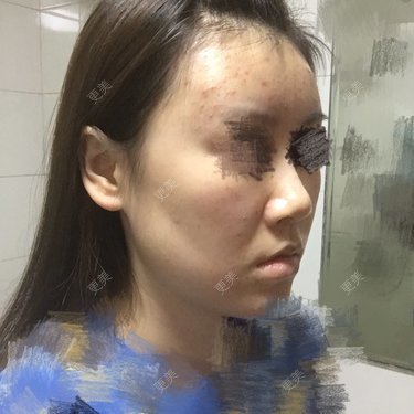 团子包子