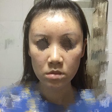 团子包子