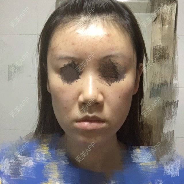 更美 - 团子包子的经验 | 在线面诊四 | 面部轮廓 | 改脸型