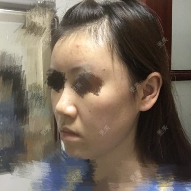 团子包子