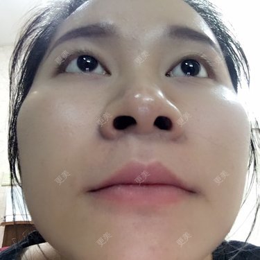 权志琳