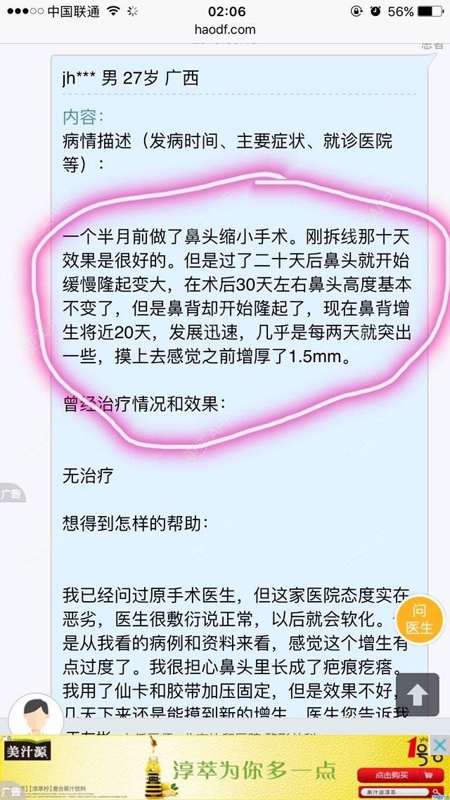 更美 - 权志琳的经验 | 鼻部整形 | 鼻部多项 | 鼻翼鼻头缩小 | 广州